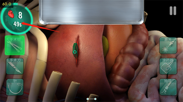 医院手术时间图片